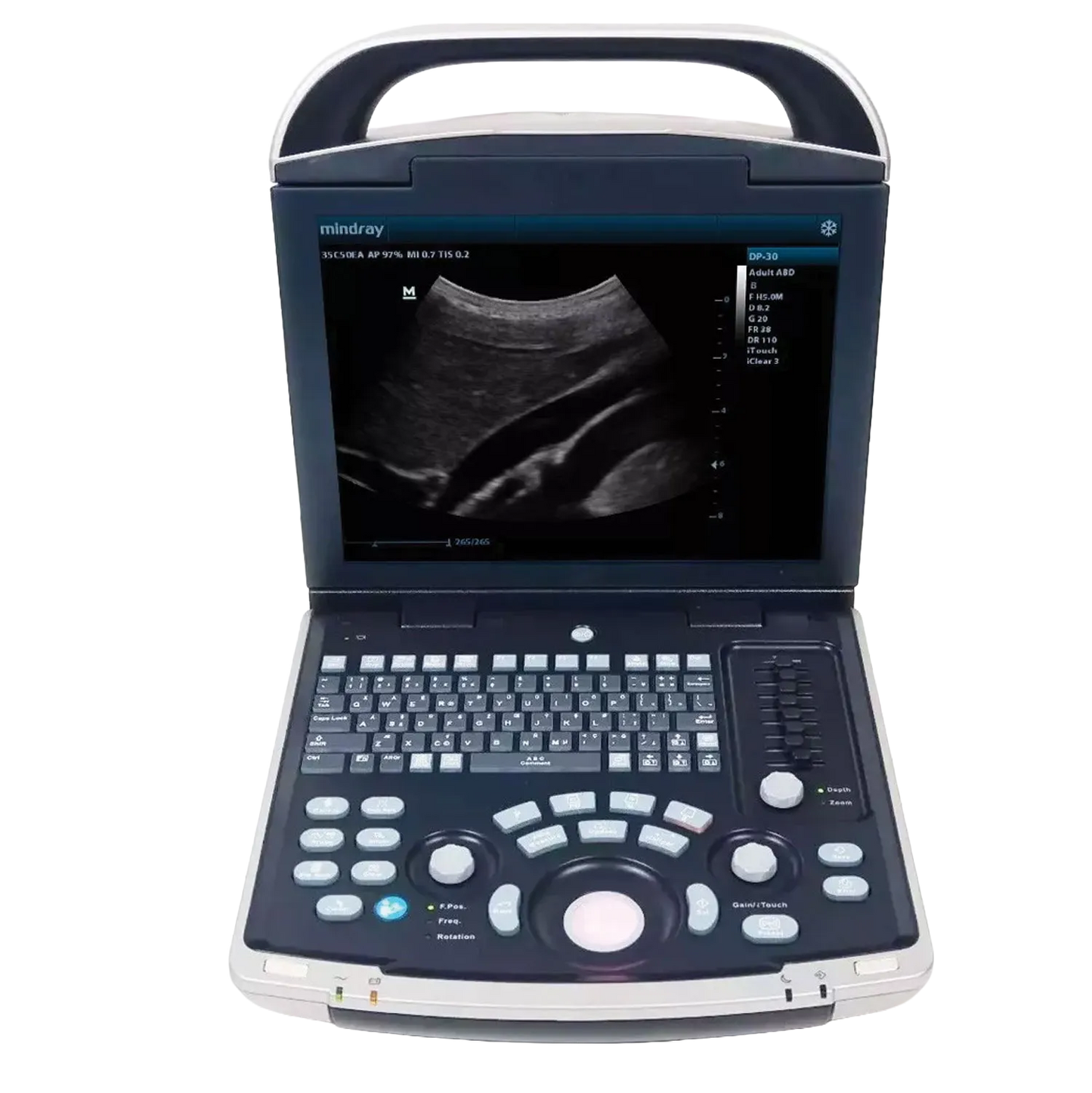 Equisound DP30 Portable Equine Ultrasound,"Open portable ultrasound machine with screen and control panel"