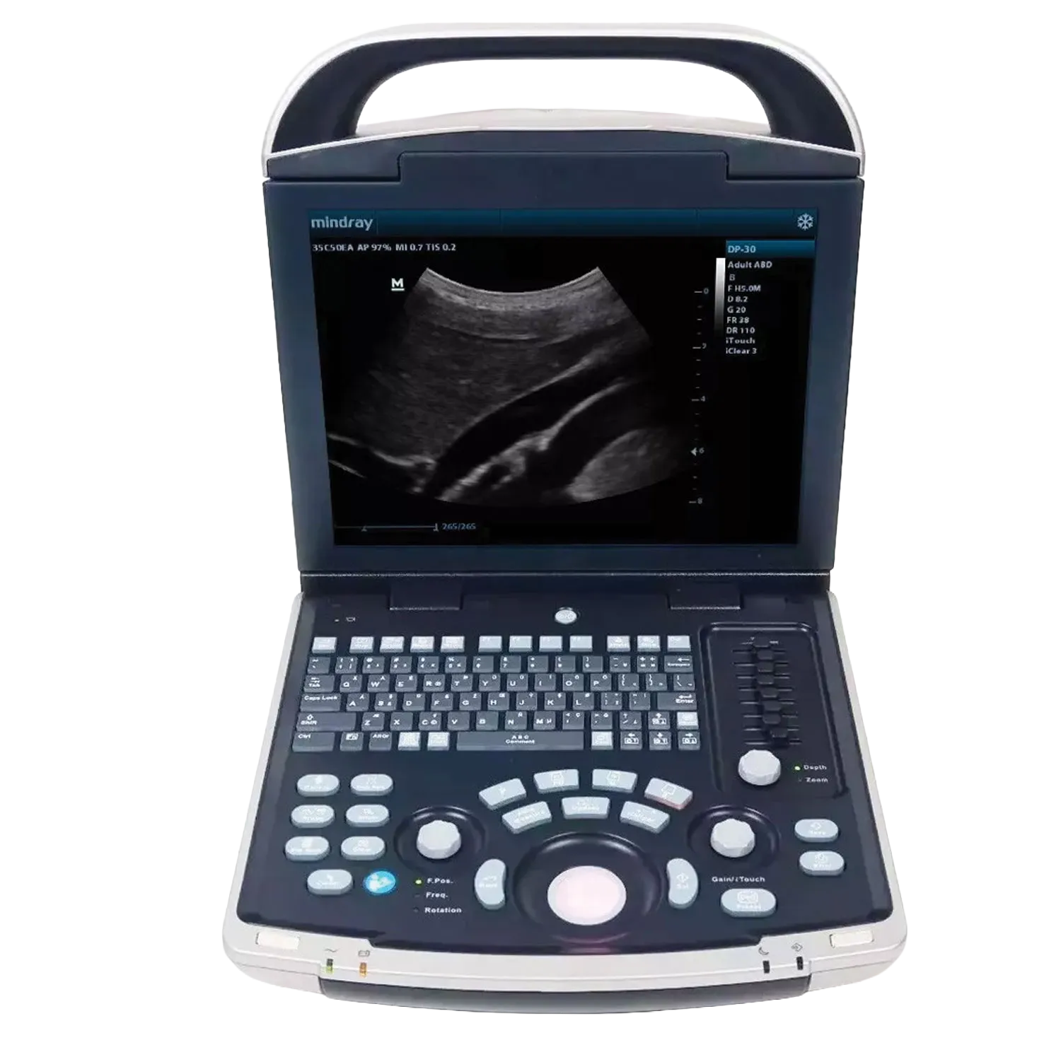 Equisound DP30 Portable Equine Ultrasound,"Open portable ultrasound machine with screen and control panel"