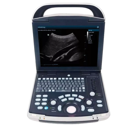 Equisound DP30 Portable Equine Ultrasound,"Open portable ultrasound machine with screen and control panel"