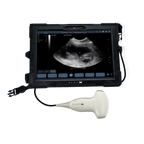 ScanX Portable Ultrasound,"Tablet display with connected handheld ultrasound probe"