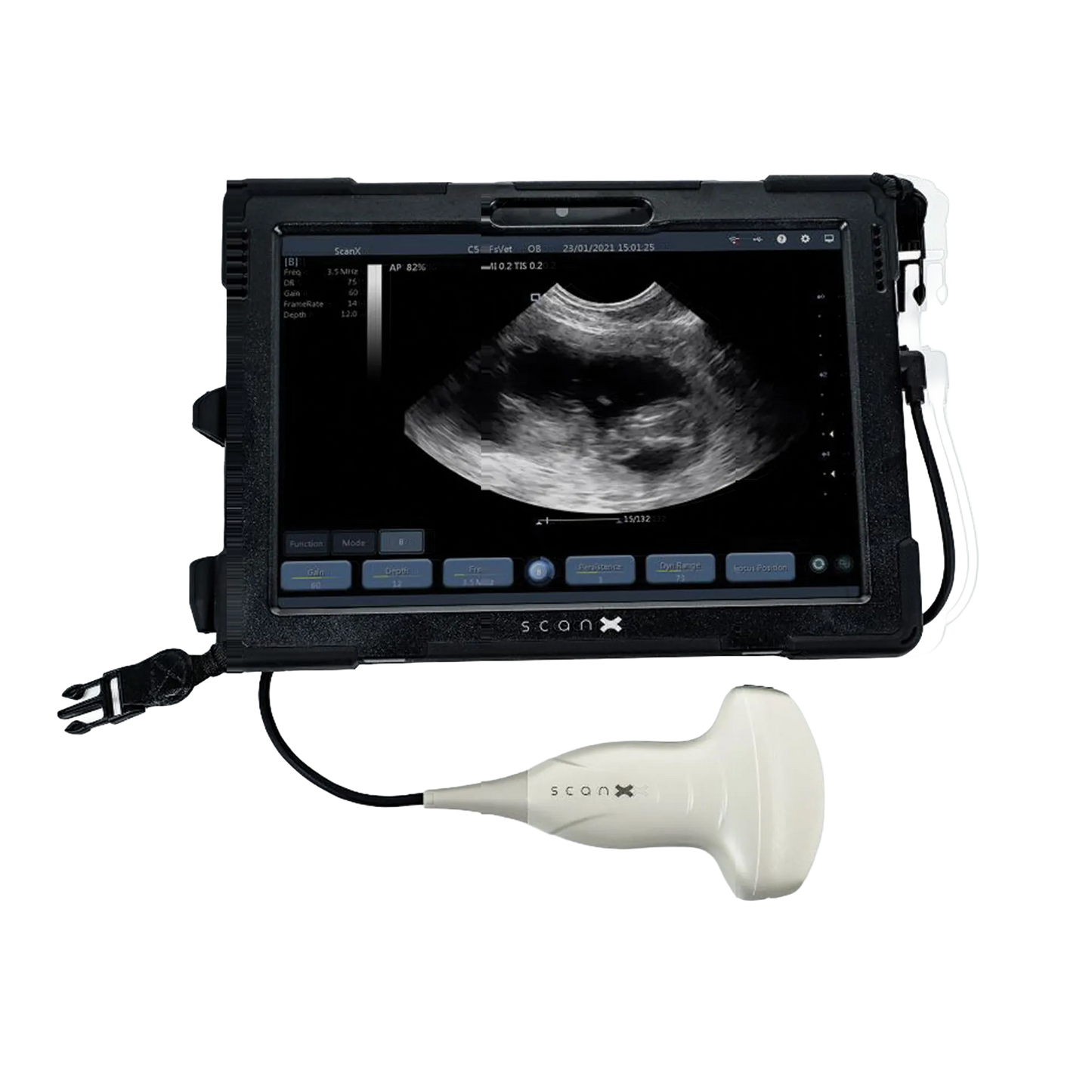 ScanX Portable Ultrasound,"Tablet display with connected handheld ultrasound probe"