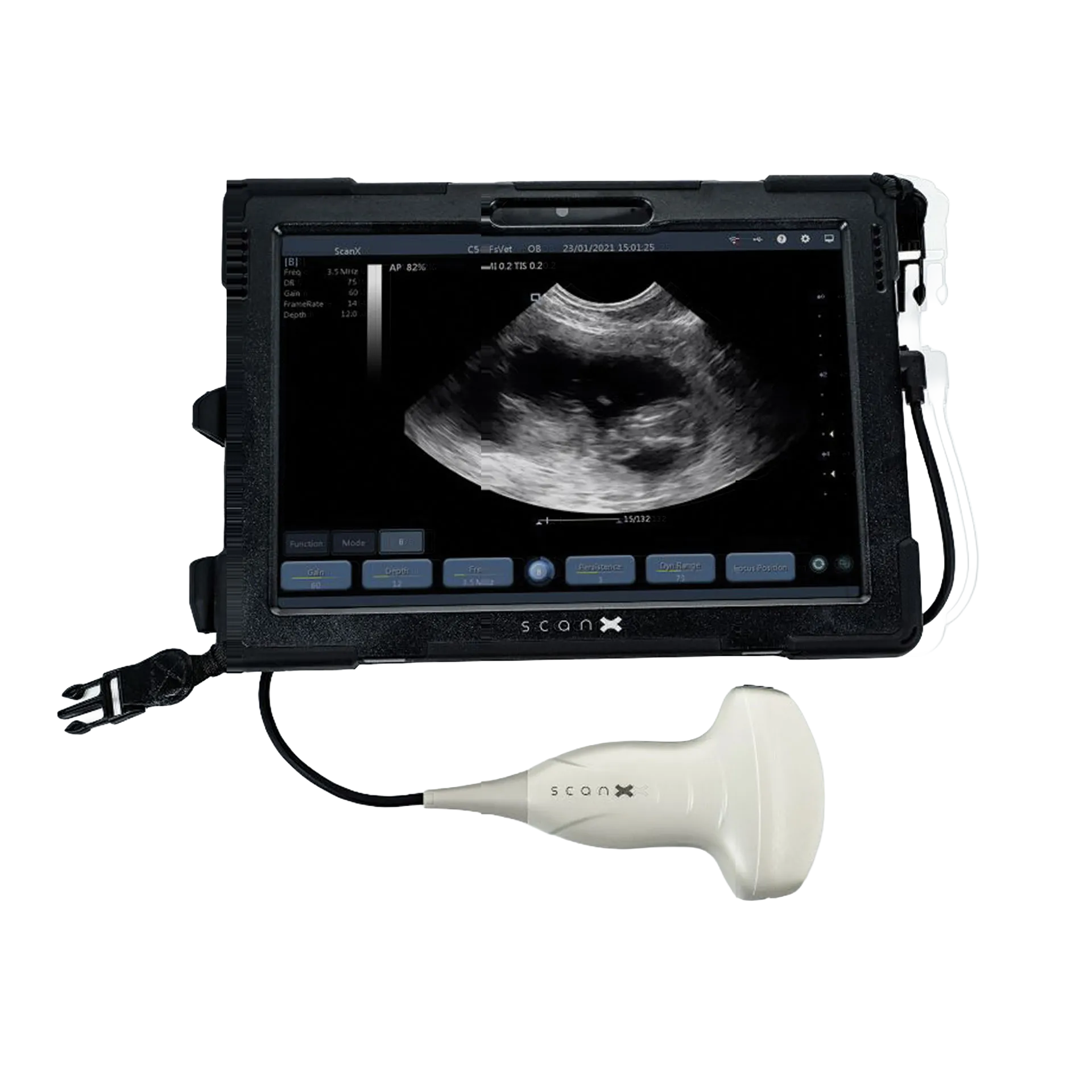 ScanX Portable Ultrasound,"Tablet display with connected handheld ultrasound probe"