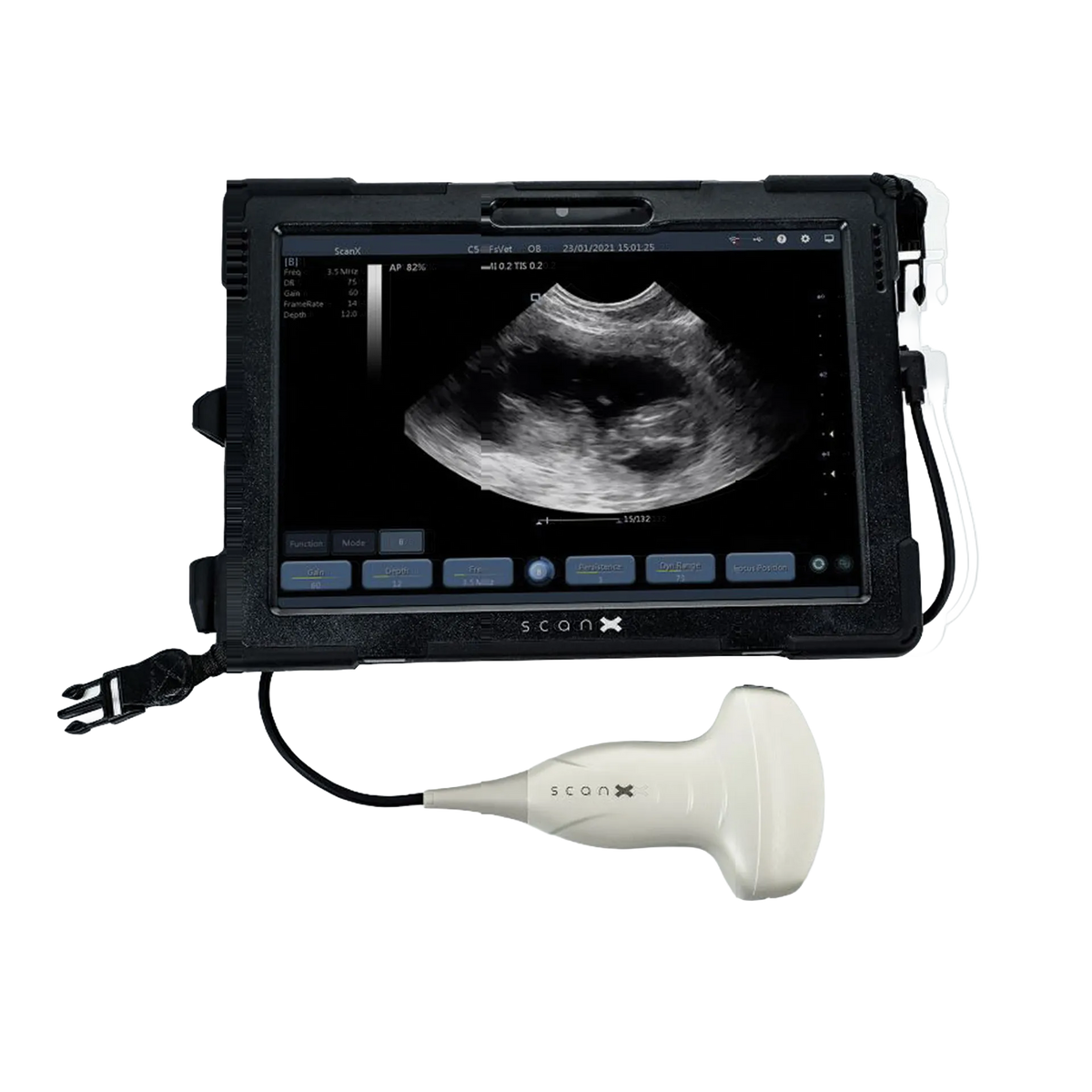 ScanX Portable Ultrasound,"Tablet display with connected handheld ultrasound probe"