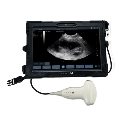 ScanX Portable Ultrasound,"Tablet display with connected handheld ultrasound probe"