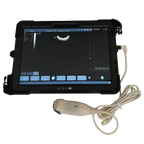 ScanX Portable Ultrasound,"Portable ultrasound tablet with attached probe and cable"