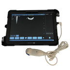 ScanX Portable Ultrasound,"Portable tablet ultrasound with attached probe and cable"