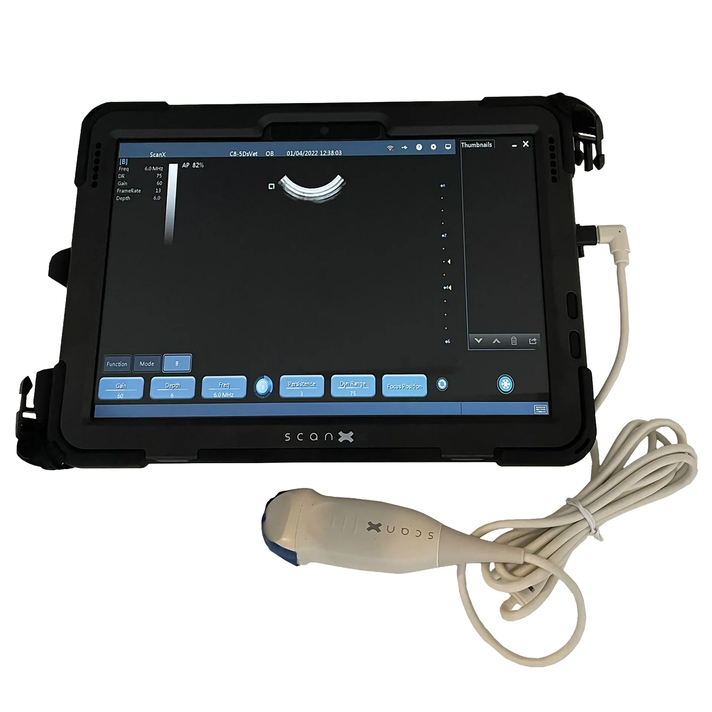 ScanX Portable Ultrasound,"Portable tablet ultrasound with attached probe and cable"