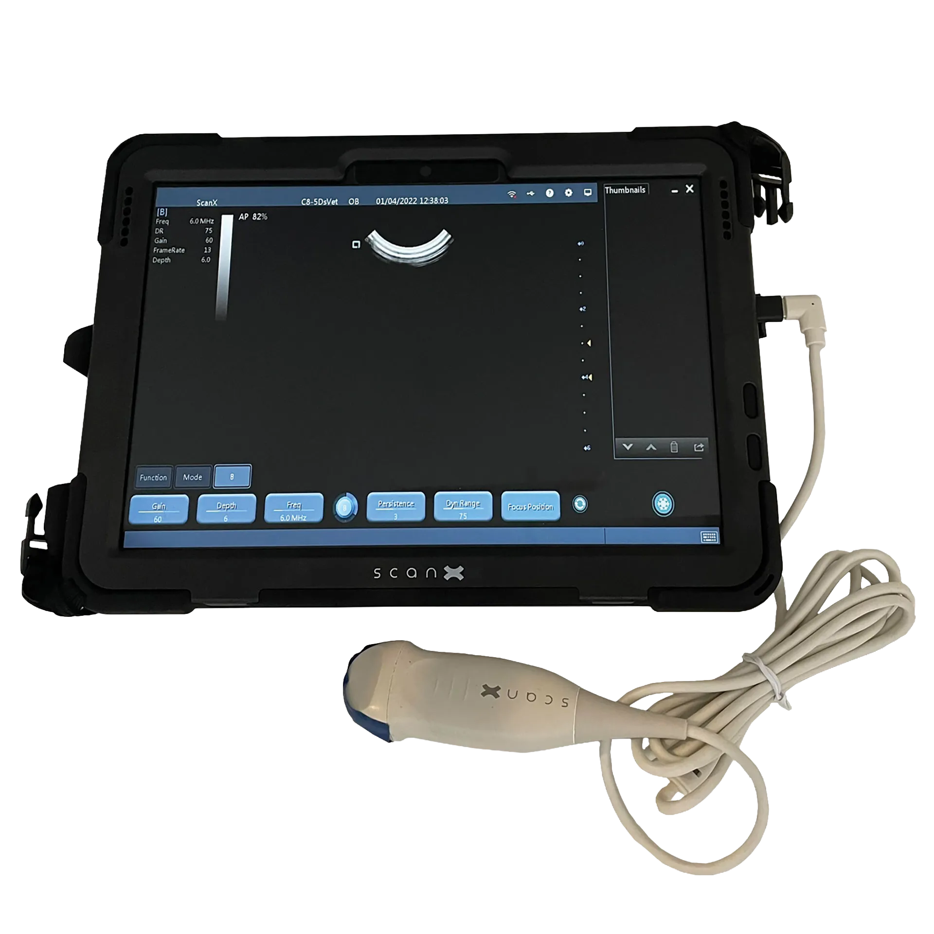 ScanX Portable Ultrasound,"Portable tablet ultrasound with attached probe and cable"