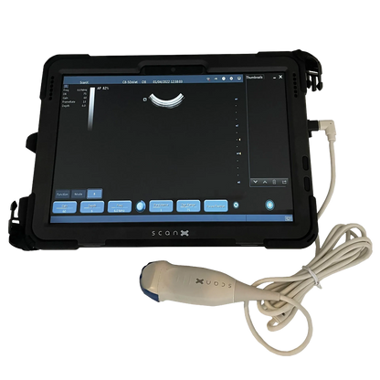 ScanX Portable Ultrasound,"Portable tablet ultrasound with attached probe and cable"
