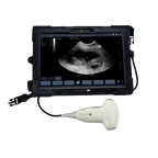 ScanX Portable Ultrasound,"Portable monitor with handheld ultrasound probe"