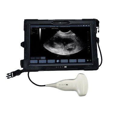 ScanX Portable Ultrasound,"Portable monitor with handheld ultrasound probe"