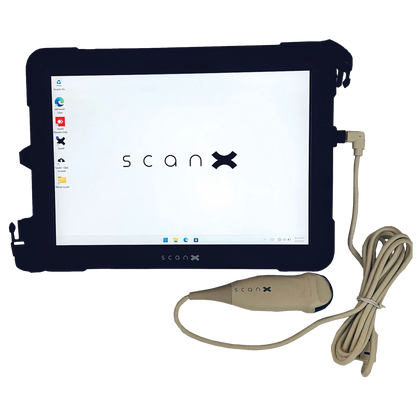 ScanX Portable Ultrasound,"Tablet display with connected handheld ultrasound probe"